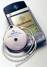 Medtronic%20Infusion%20Pump.jpg